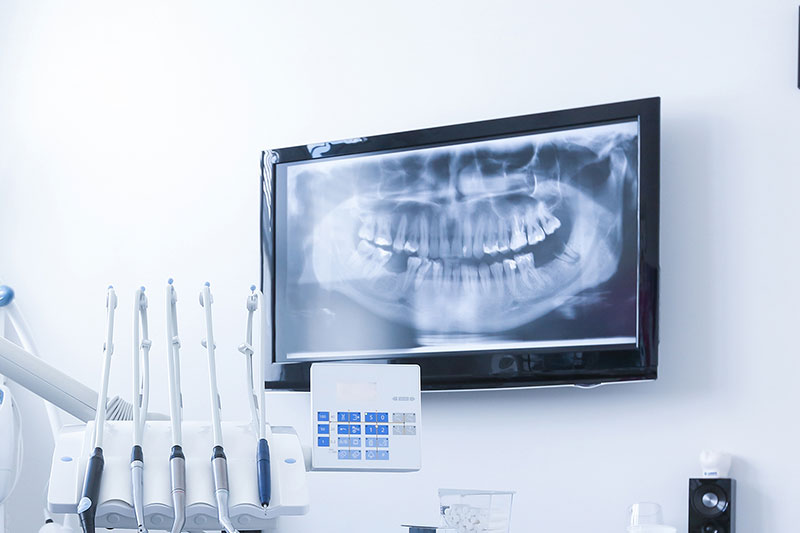 digital-dental-xray.jpg